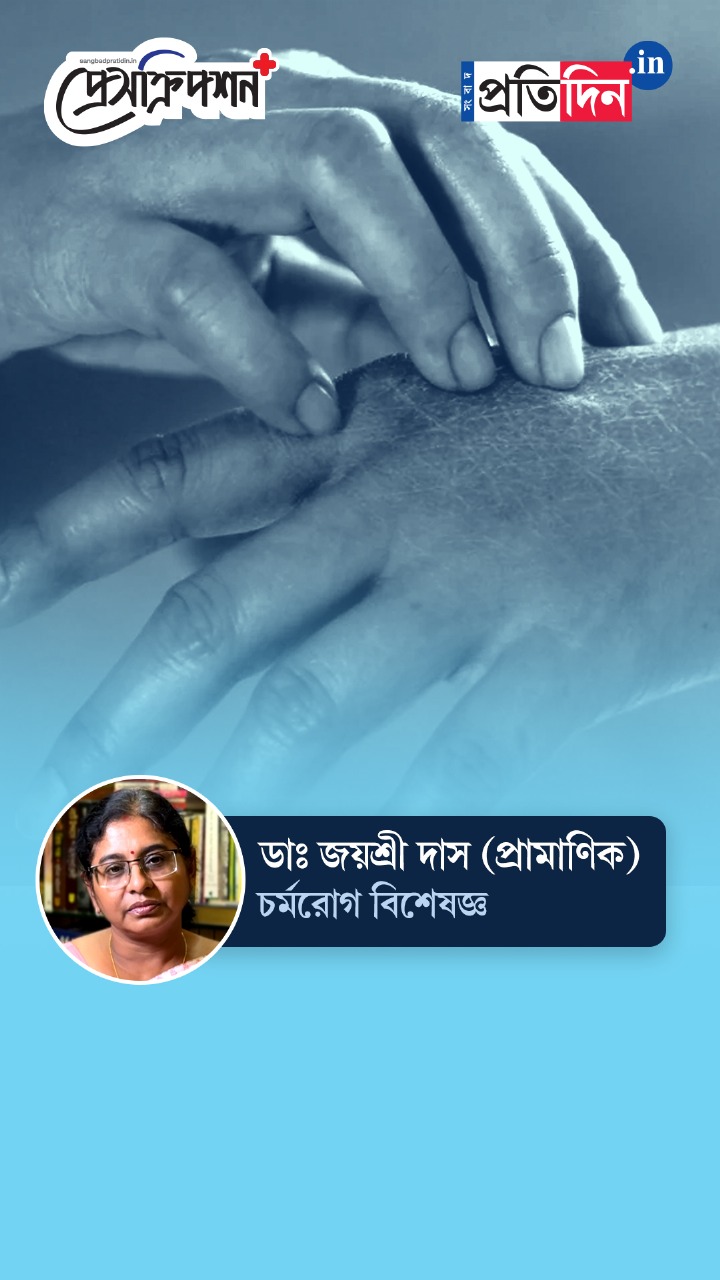 Fungal Infection | বর্ষায় ছত্রাক-ঘটিত সংক্রমণ থেকে বাঁচার উপায় জানাচ্ছেন ডাঃ জয়শ্রী দাস (প্রামাণিক)